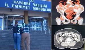 Midesinde 1 kilo uyuşturucu bulunan şüpheli tutuklandı