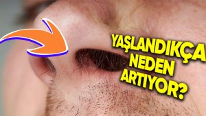 Yaşlandıkça burun kılları neden artıyor?